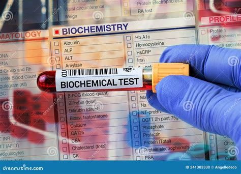 biochemical analysis test